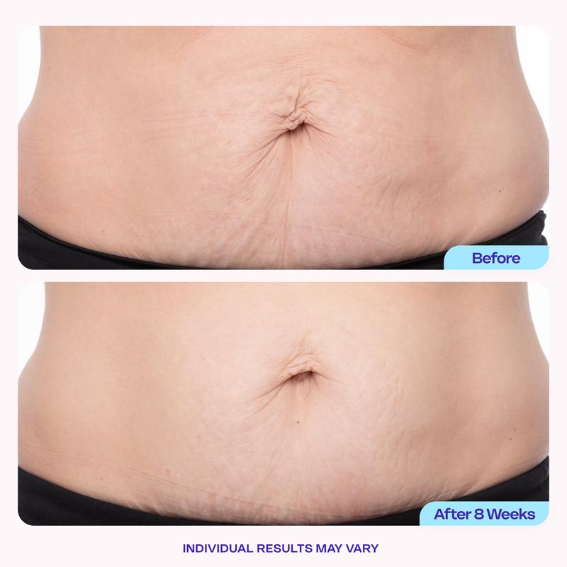 Pura Glow Tighten & Smooth Belly Cream